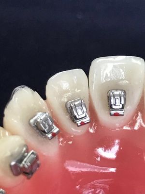 Clínica Tubos Molares Brackets Lingual Dental para DTC Ortodontia Bracket auto-ligado