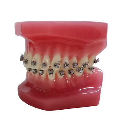 DTC Ortodontia Dental Typodont Brackets Modelo personalizado feito para manual e OEM